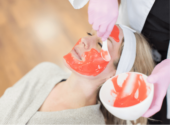 Step 2: Chemical Peel Treatment
