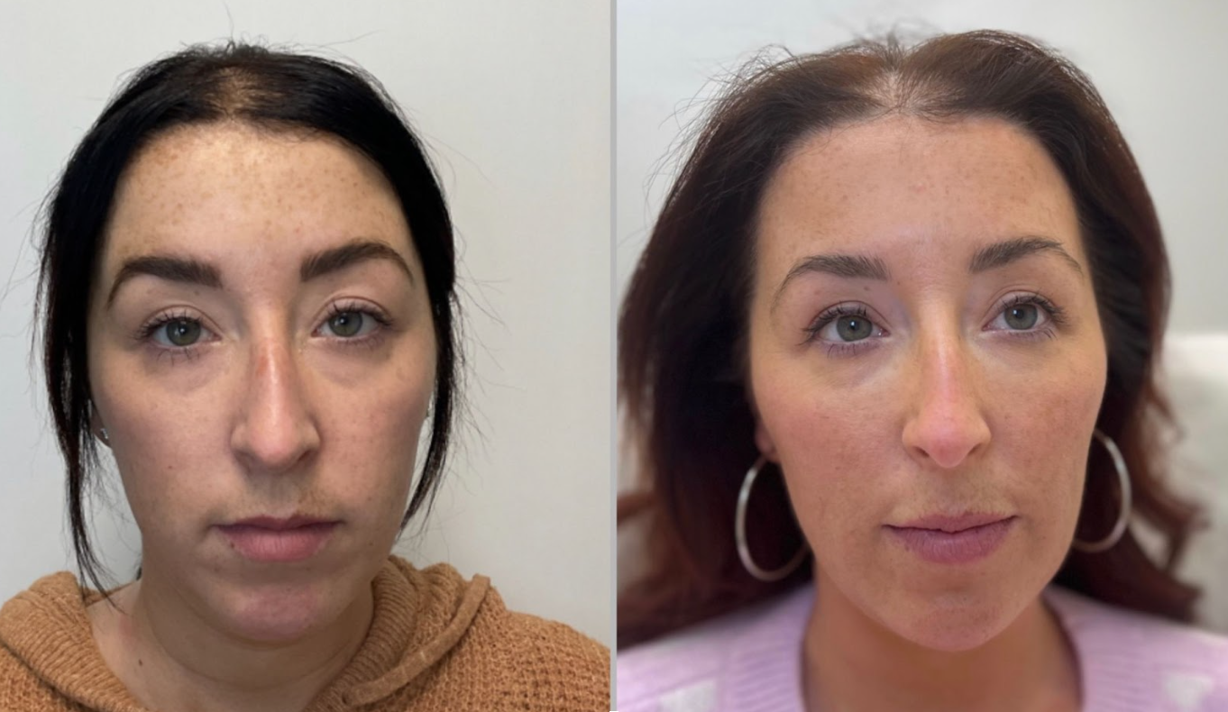 Treatment Plans Anti Aging Treatments Take Time 4esthestics Lounge treatment-plans-anti-aging-treatments-take-time-4esthestics-lounge